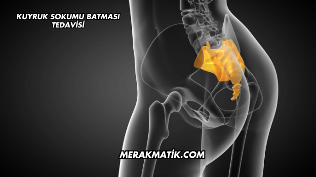 Kuyruk Sokumu Batması Tedavisi